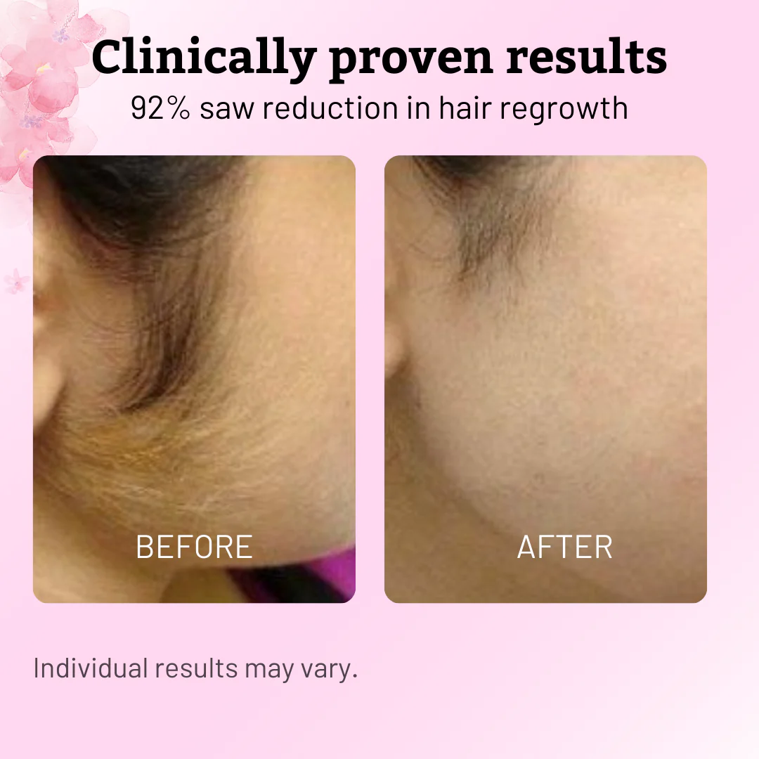 Cyperus Rotundus Oil for Hair Reduction Natural Permanent Hair Reduction