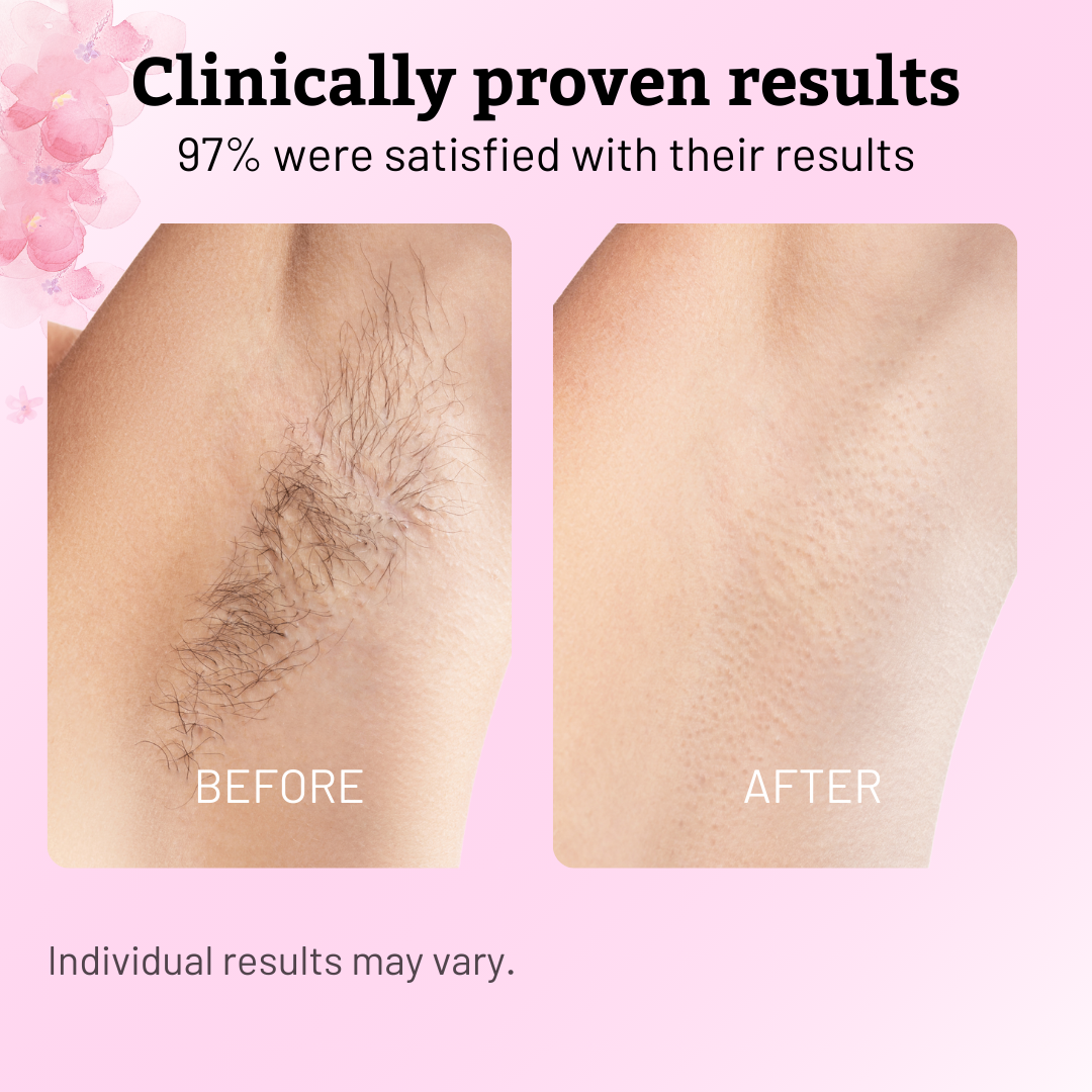 Cyperus Rotundus Oil for Hair Reduction Natural Permanent Hair Reduction